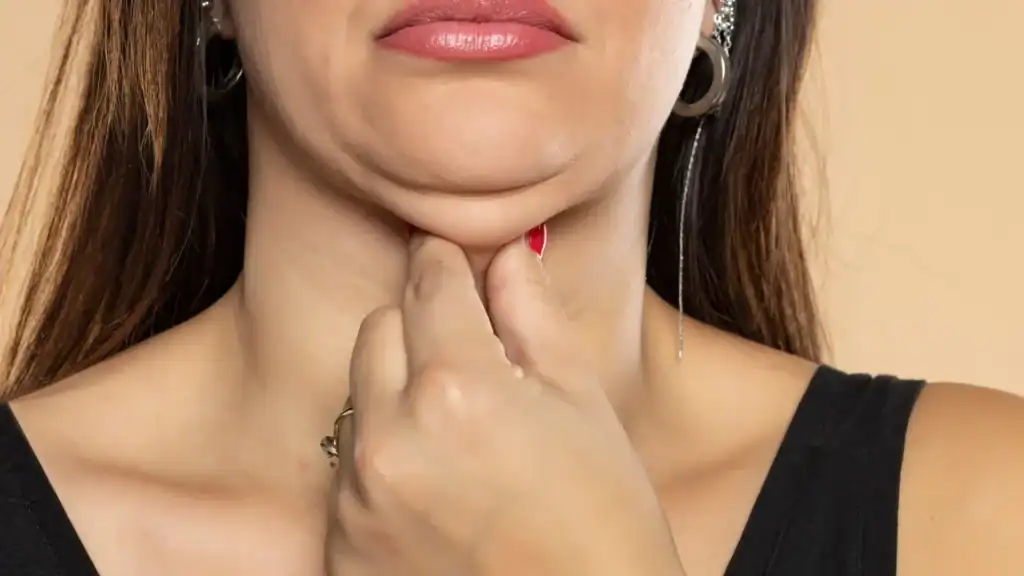 An image of a woman with double chin, sad, worried : Non Surgical Double Chin Removal Treatment in Epsom, UK