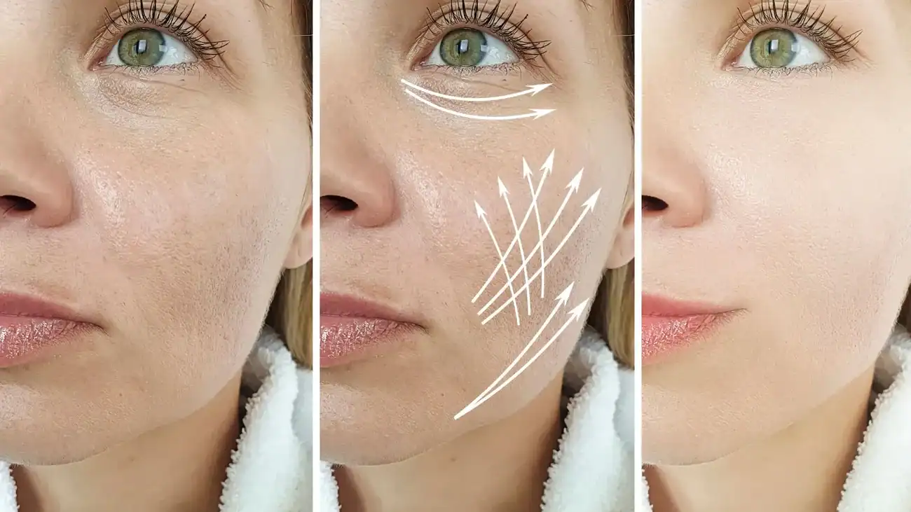 Can One Treatment Really Tackle More Than One Skin Concern Epsom?