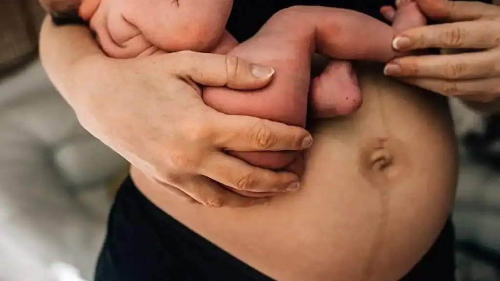 Why Is My Stomach Still Big After Pregnancy Epsom?